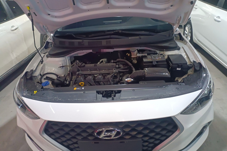 现代 悦动 2018款 1.6L 自动悦目版GL 国VI局部细节24