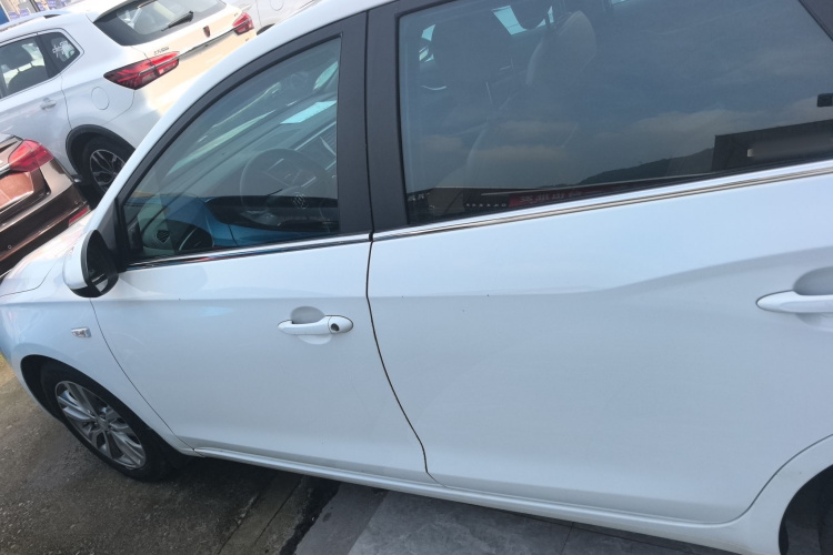 别克 英朗 2018款 18T 自动旗舰型车身外观4