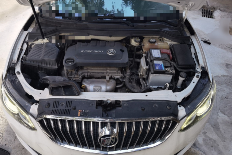 别克 英朗 2015款 15N 自动精英型局部细节24