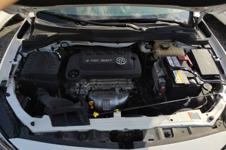 别克 英朗 2021款 改款 典范 1.5L 自动精英型局部细节24