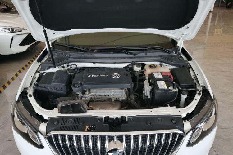 别克 英朗 2016款 15N 自动豪华型局部细节24