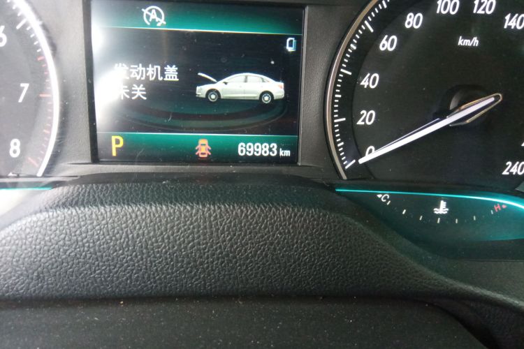 别克 英朗 2017款 15N 自动精英型中控内饰15