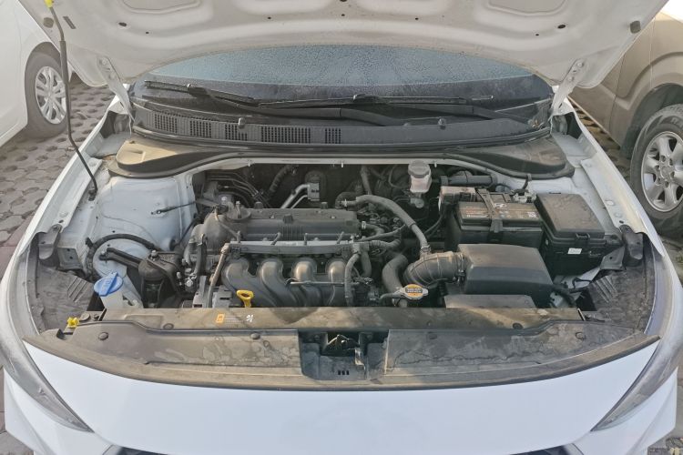 现代 悦动 2018款 1.6L 自动悦目版GL 国VI局部细节24