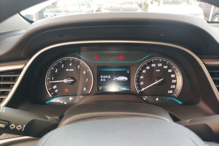 别克 英朗 2021款 改款 典范 1.5L 自动精英型局部细节14
